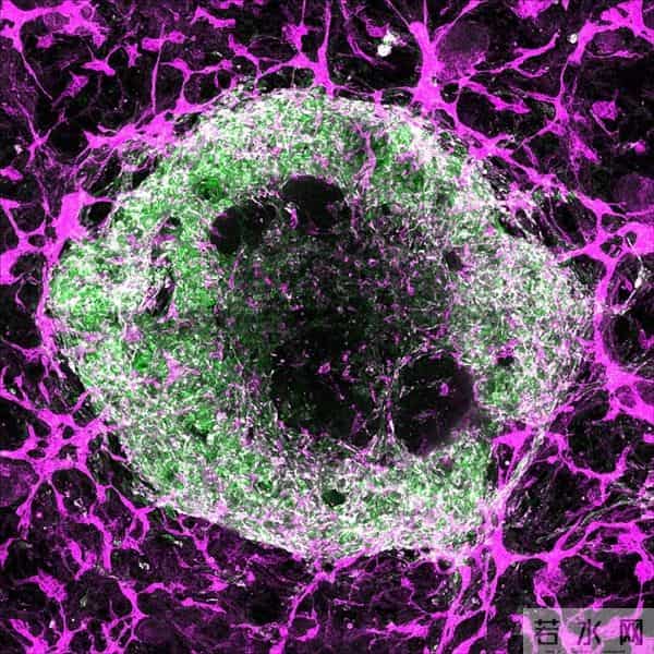 破局!阿尔茨海默病迎来克星,Sox9 激活大脑保洁队,记忆能保住了