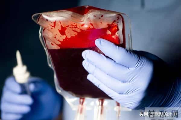 日本军备“万能血浆”是什么原理？哪些国家有这项技术？