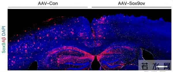 破局!阿尔茨海默病迎来克星,Sox9 激活大脑保洁队,记忆能保住了