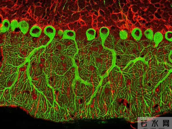 破局!阿尔茨海默病迎来克星,Sox9 激活大脑保洁队,记忆能保住了