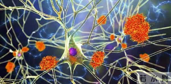 破局！阿尔茨海默病迎来克星，Sox9 激活大脑保洁队，记忆能保住了