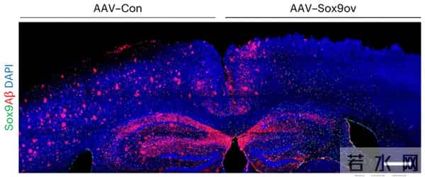 最新科学研究显示,增加一种蛋白质含量可以重新激活衰老的脑细胞