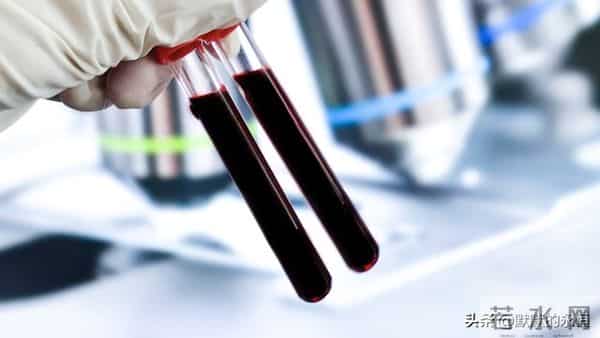 日本军备“万能血浆”是什么原理？哪些国家有这项技术？