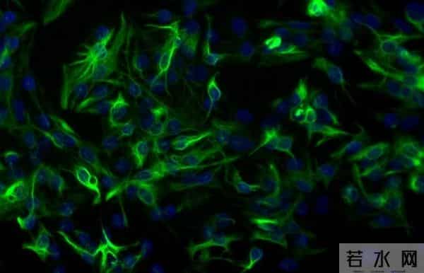 破局！阿尔茨海默病迎来克星，Sox9 激活大脑保洁队，记忆能保住了