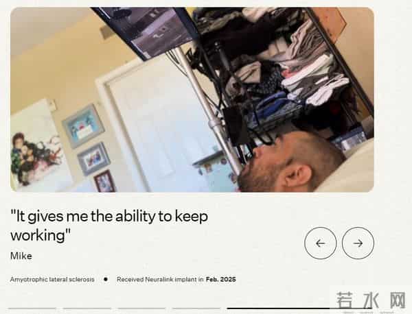 马斯克脑机又出丑闻?神秘4号人间蒸发!表面开心私下却说想死?