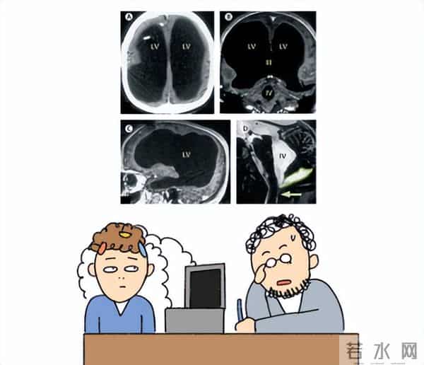 人脑只开发了10%？那100%全开得是啥样啊？