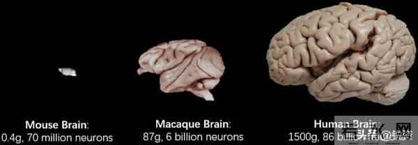 换脑试验领跑全球!9500万抑郁症患者有救?国家给出新方案