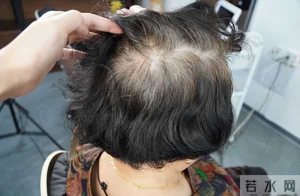 最新研究发现揭秘-头上每一根白发，可能都是抗病防御的外在表现