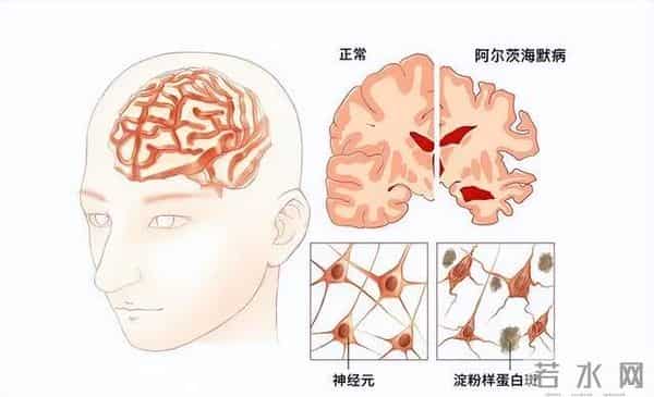 科学家发现“僵尸基因”，死后4天仍企图把主人“复活”？