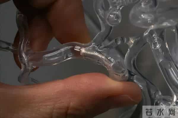 牛！2025中国5大科技惠民，激光除草、看病少遭罪，项项关系日常