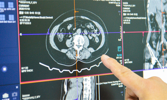 医用胶片行业发展概况及市场供需态势分析2024